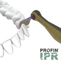 Profin PDX, IPR Tips, Dentatus